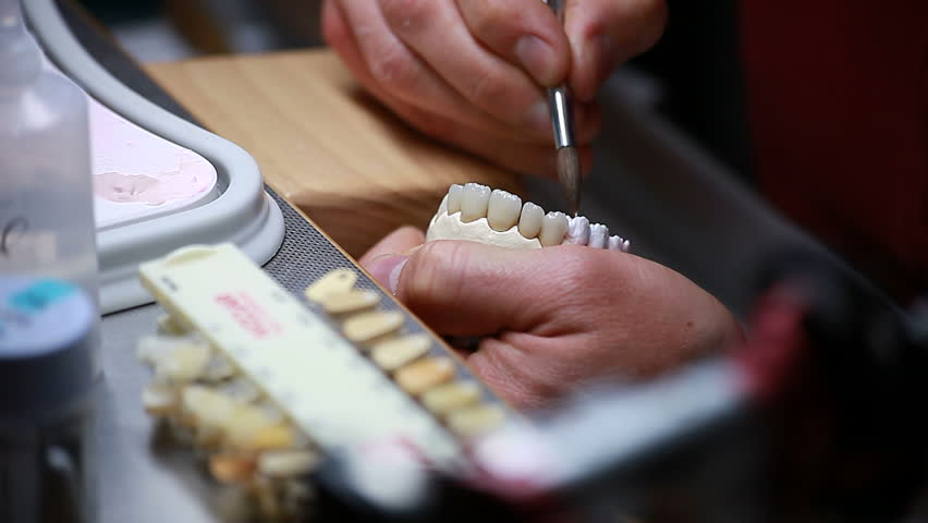 Dental implants (brushing)