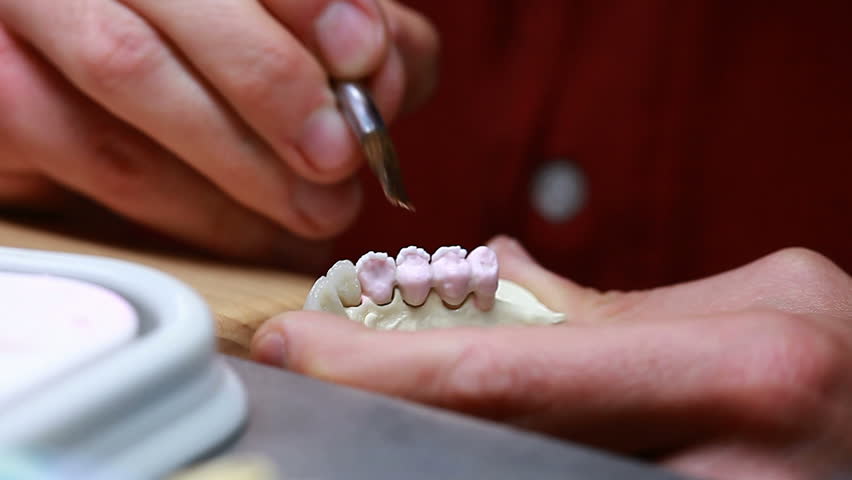 Dental implants laboratory sequence 