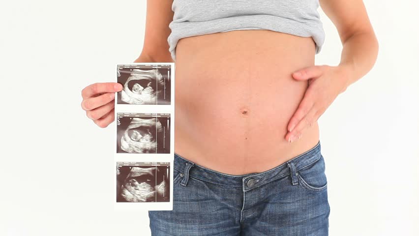 Belly of a pregnant woman with ultrasound scan against a white background