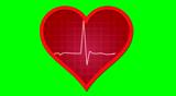 EKG heart monitor