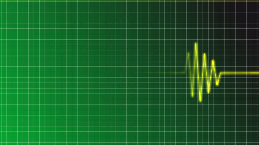 ECG curve with christian cross