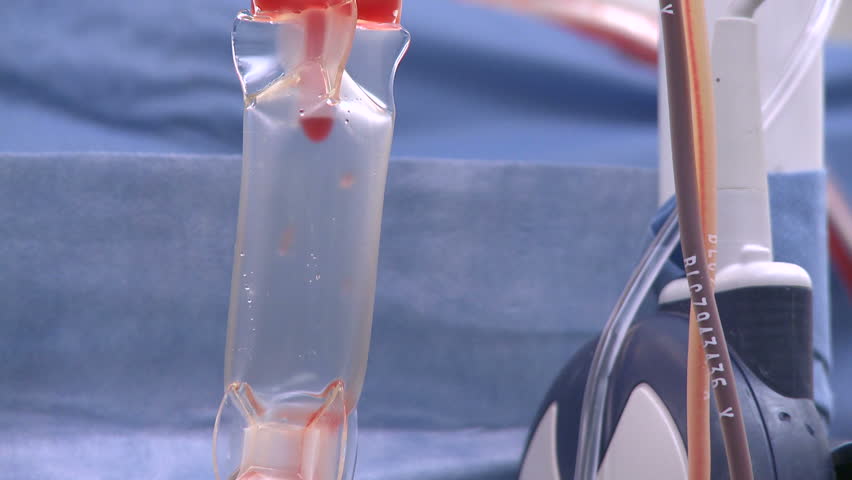 Blood drip during surgery