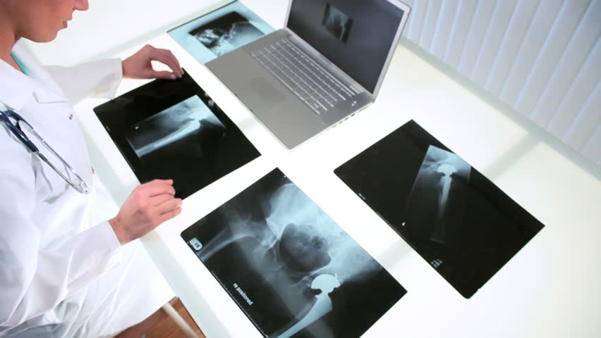 Young female doctor working in radiology department with x-ray films and computer technology