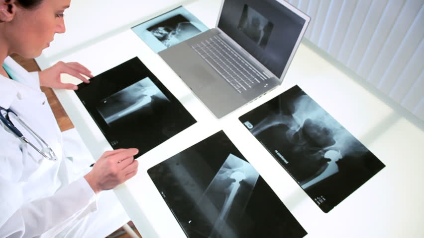 Young female doctor working in radiology department with x-ray films and computer technology
