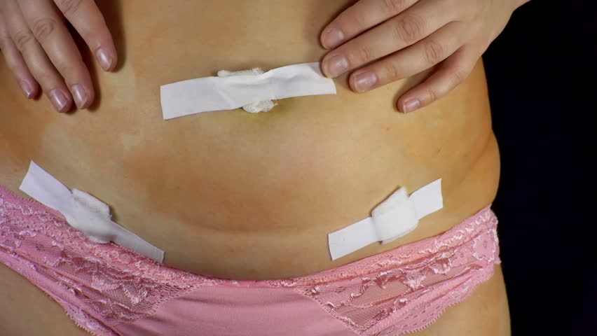 Header of adhesive plaster