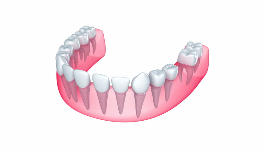 Implant is embedded in the gum