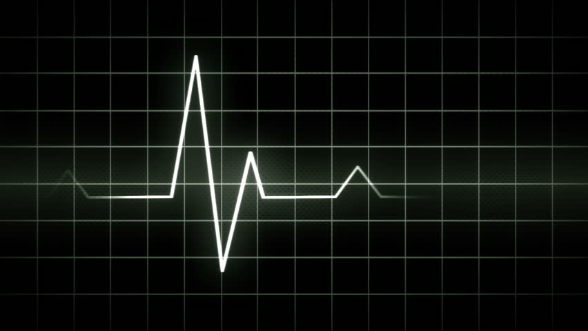 looping EKG display electrocardiogram pulse real waveform