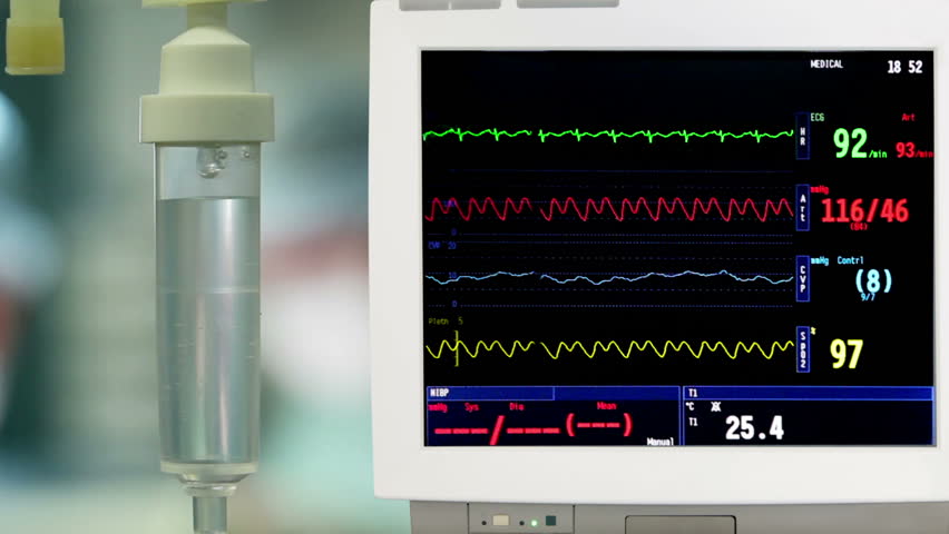 Drip with ECG monitor in operation room. Moving camera