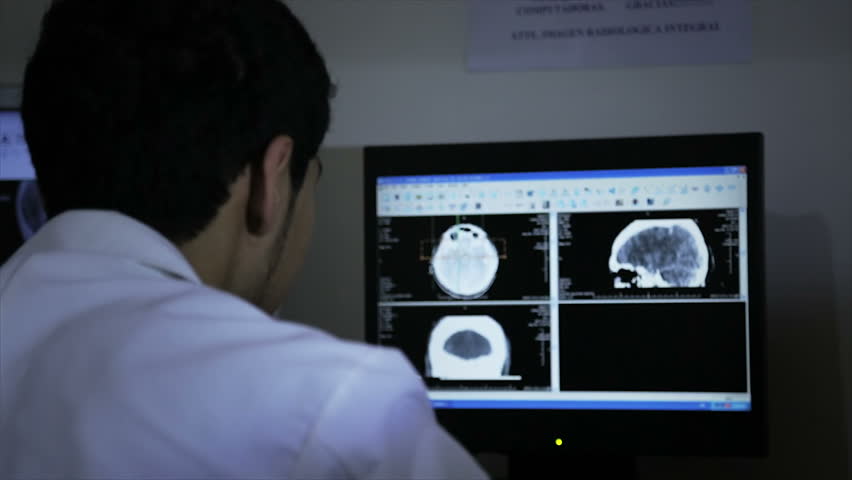 Neurologist examine possible brain tumor in monitor 