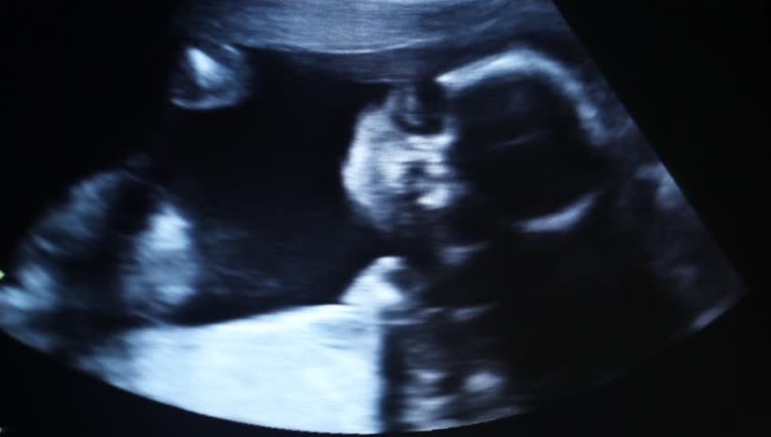 Ultrasound 5 months baby