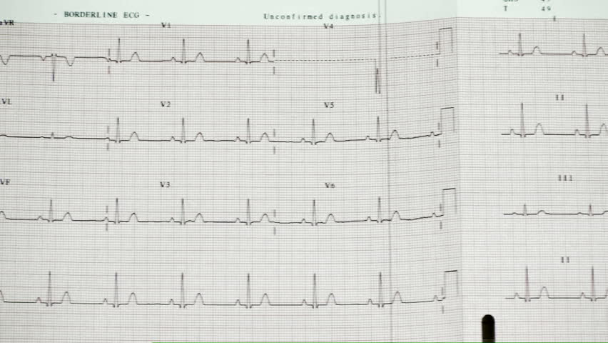 1920x1080 Full page ECG recording. 