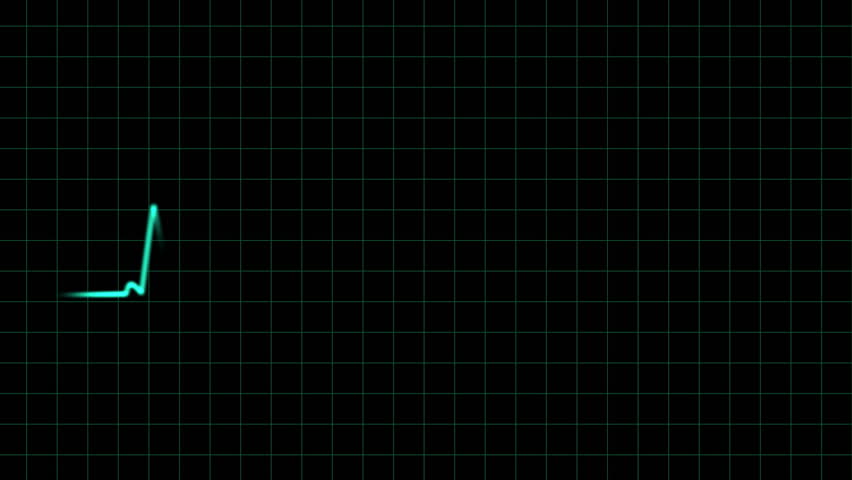 EKG heartbeat monitor, animation