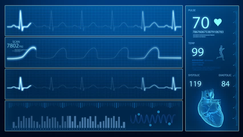 Ecg - cardiogram concept in loop