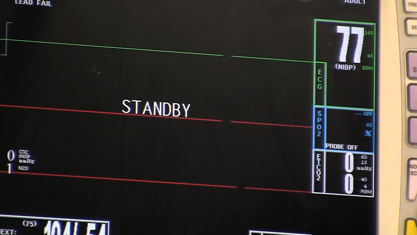 Static of heart monitor machine on standby showing no heart beat.