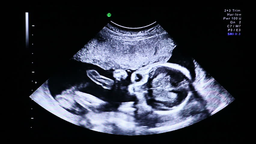 Ultrasound ecography. Gynecological medical examination. 22 weeks old pregnancy. 