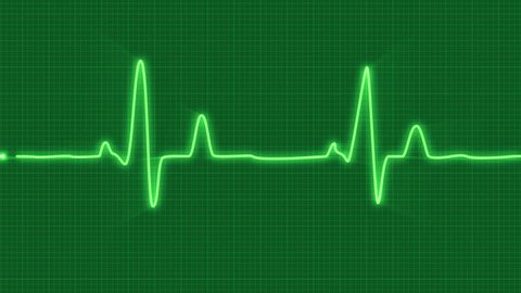 Looped Animated Ecg Electrocardiogram Display Heart Stock Footage Video  (100% Royalty-free) 14718202 | Shutterstock