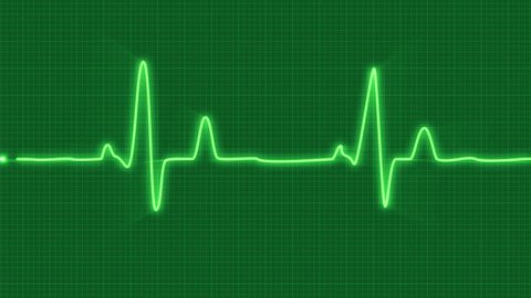 Looped Animated Ecg Electrocardiogram Display Heart Stock Footage Video (100% Royalty-free) 14718202 | Shutterstock Looped Animated Ecg Electrocardiogram Display Heart Stock Footage Video (100% Royalty-free) 14718202 | Shutterstock