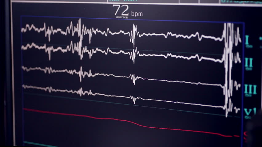 Header of cardiology