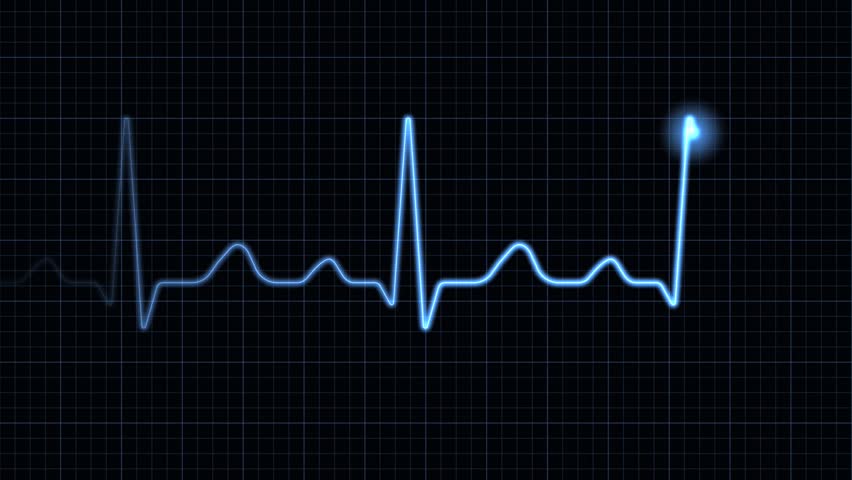Ecg Motion Desktop Wallpaper Loopable Background EKG Electrocardiogram