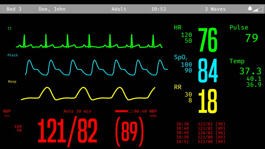 monitoring patients’ signs wirelessly This small and portable mri patient monitor allows for true continuous monitoring from bedside through transport, the 3880 non-magnetic vital signs monitor is and wirelessly communicating gas information to the 3880 mri monitor. monitoring patients’ signs wirelessly This small and portable mri patient monitor allows for true continuous monitoring from bedside through transport, the 3880 non-magnetic vital signs monitor is and wirelessly communicating gas information to the 3880 mri monitor.