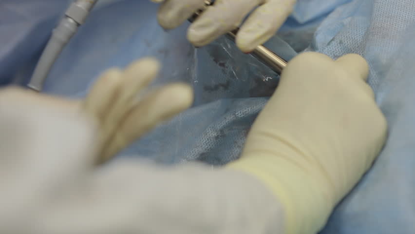 Header of lithotripsy