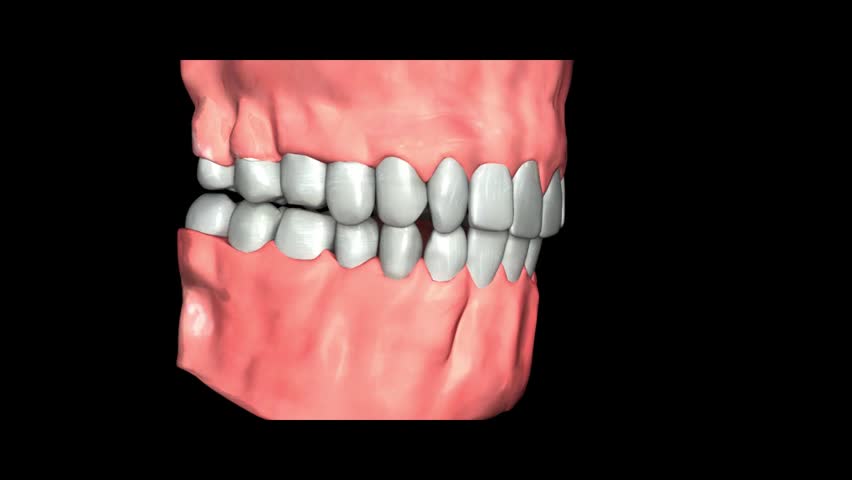 Header of premolar