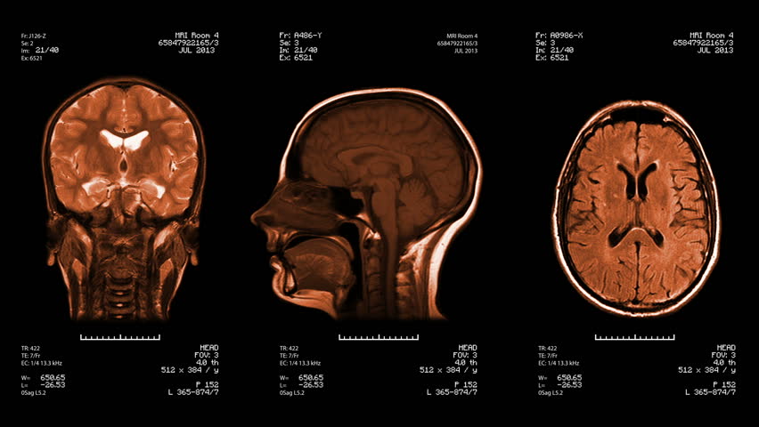 Three head views of MRI scan. Loopable. Amber.
See more color options in my portfolio.