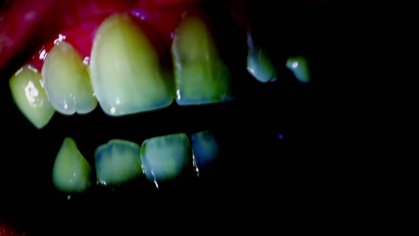 Bad Teeth Stock Footage Video (100% Royalty-free) 5378792 | Shutterstock