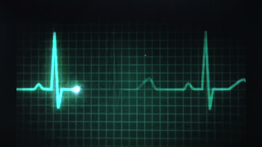 Ecg Stock Footage Video | Shutterstock